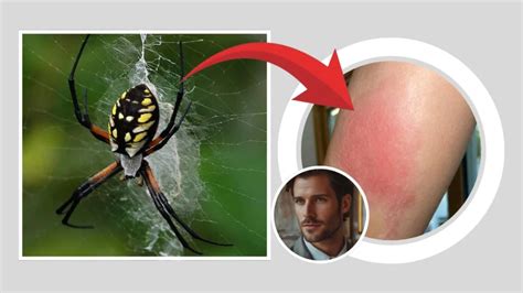 Are Spiders Nice To Humans? The Surprising Truth Revealed