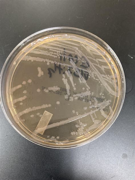 Does Freezing Kill E Coli 0157