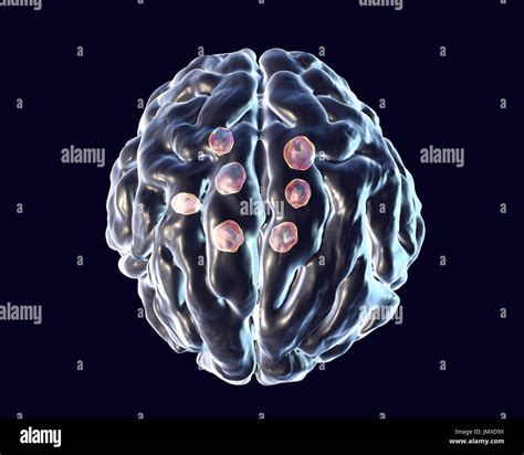 Living In The Brain Parenchyma: A Cellular Tour
