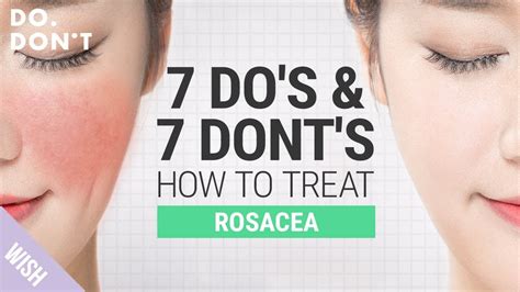 Soft Makeup For Rosacea: A Guide To Flawless Skin