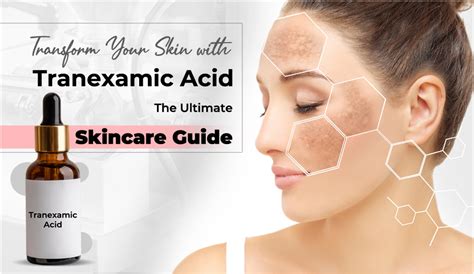 Real Skin Benefits Of Tranexamic Acid Almost Everyone Needs To Know